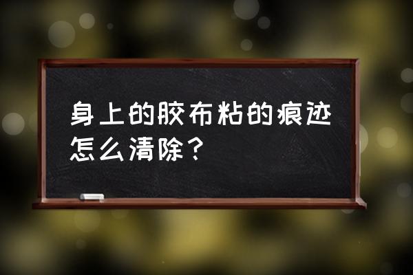 身上胶带痕迹怎样去除 身上的胶布粘的痕迹怎么清除？